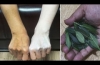 Skin Whitening Home Remedies Neem Leaves and Turmeric, Haldi Facial