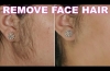 How To Remove Facial Hair Naturally | SkinCare Home Remedy | ShrutiArjunAnand