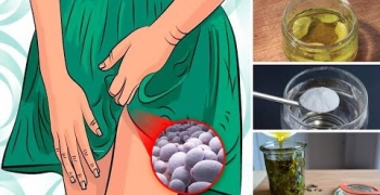 Top 8 Home Remedies for Yeast Infection (Candidiasis)